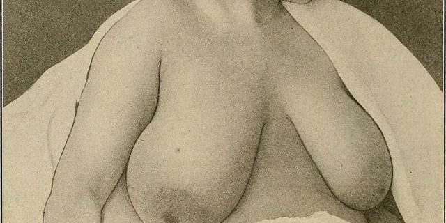 On Touching Naked Bodies (In the Clinic)